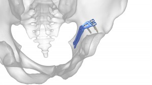 Pelvis