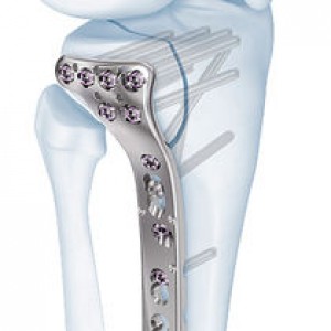 Tibia